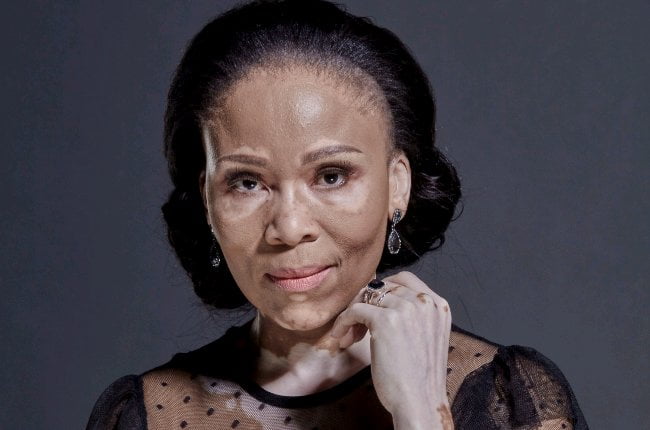 How Leleti Khumalo looked before her skin changed